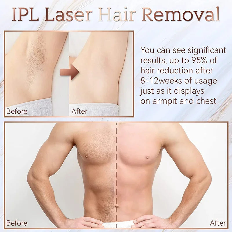 BareLuxe Laser Hair Removal 
Pro